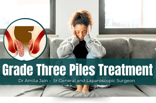 Specialised Treatment for Grade Three Piles or Internal Hemorrhoids Dr Amita Jain